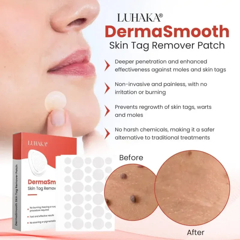 Derma Smooth Skin Tag Removal Patch🌟