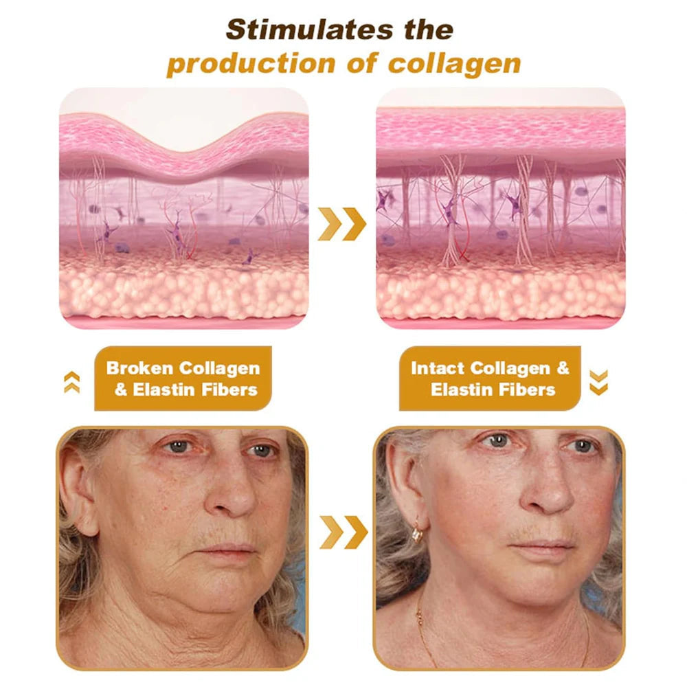 BeeTox™ - Bee Venom Wrinkle Repair Cream 🐝✨ (Buy 1 Get 1 Free 🔥)