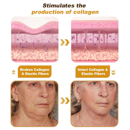 BeeTox™ - Bee Venom Wrinkle Repair Cream 🐝✨ (Buy 1 Get 1 Free 🔥)