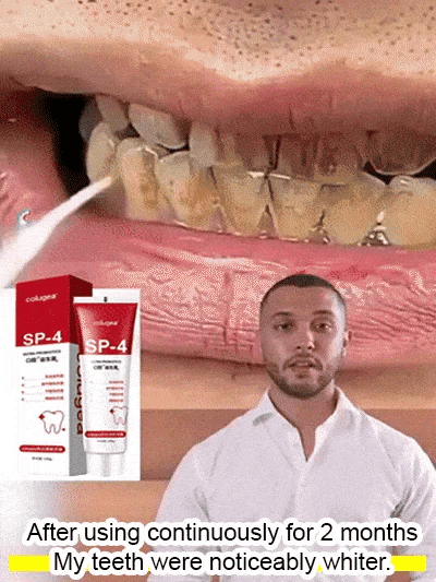 Intensive Teeth Whitening Toothpaste - Rated (⭐️⭐️⭐️⭐️⭐️ 4.8/5 By 2 Lakh+ ✅ Happy Customers)