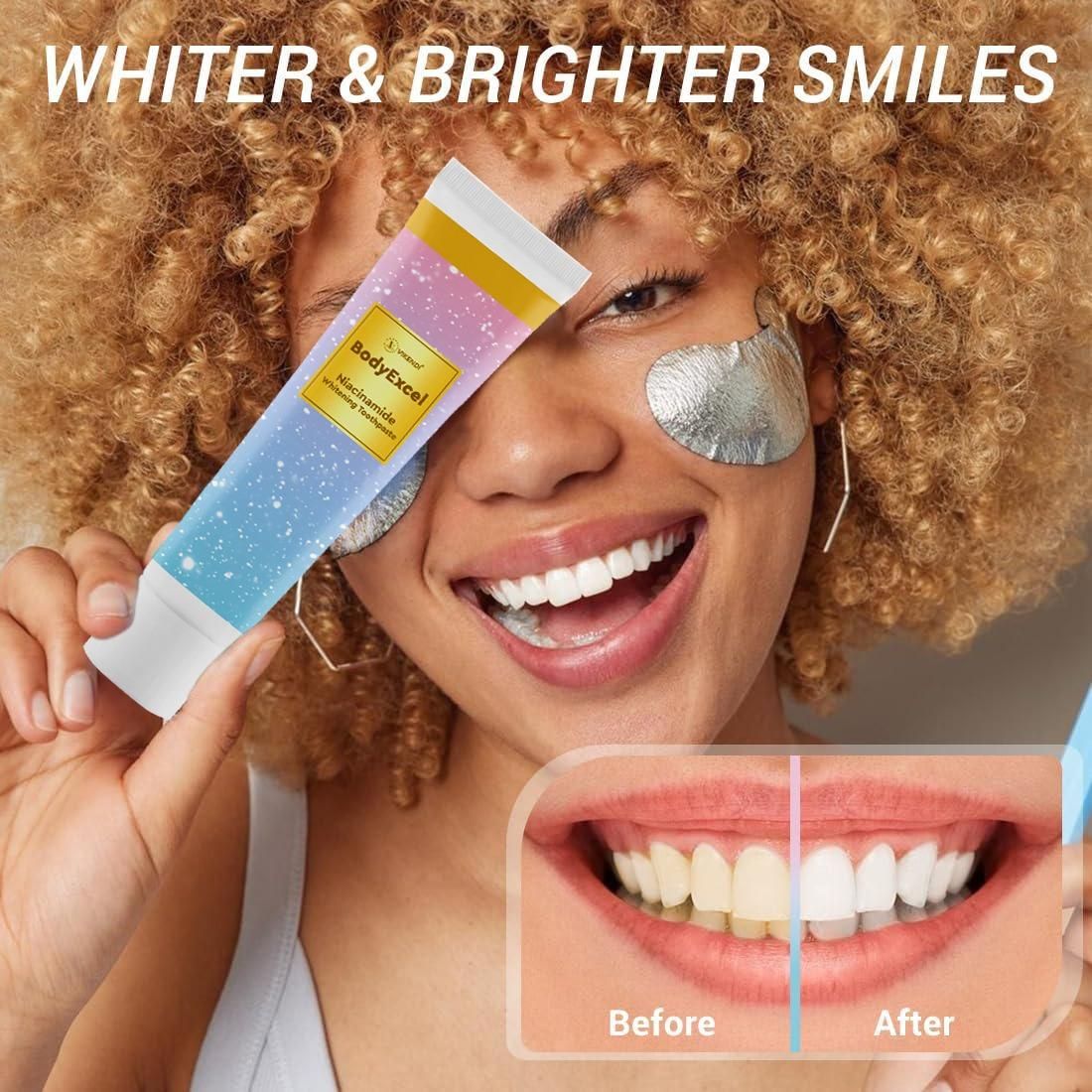 Niacinamide Whitening Toothpaste - Buy 1 Get 1 Free ⏰