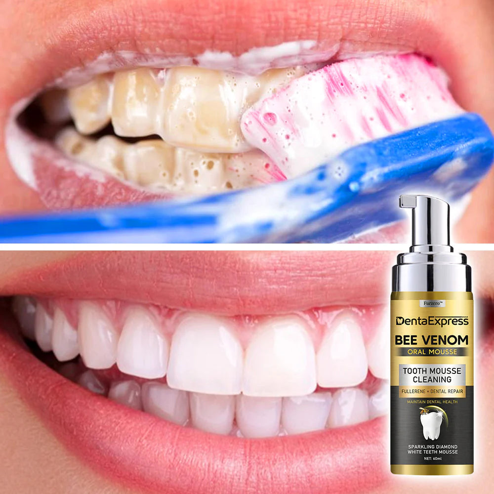 DentaExpress Bee Venom Oral Mousse