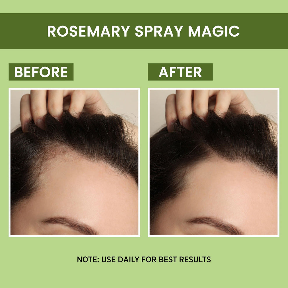 𝗕𝗨𝗬 𝟭 𝗚𝗘𝗧 𝟭 𝗙𝗥𝗘𝗘 - Rosemary Water