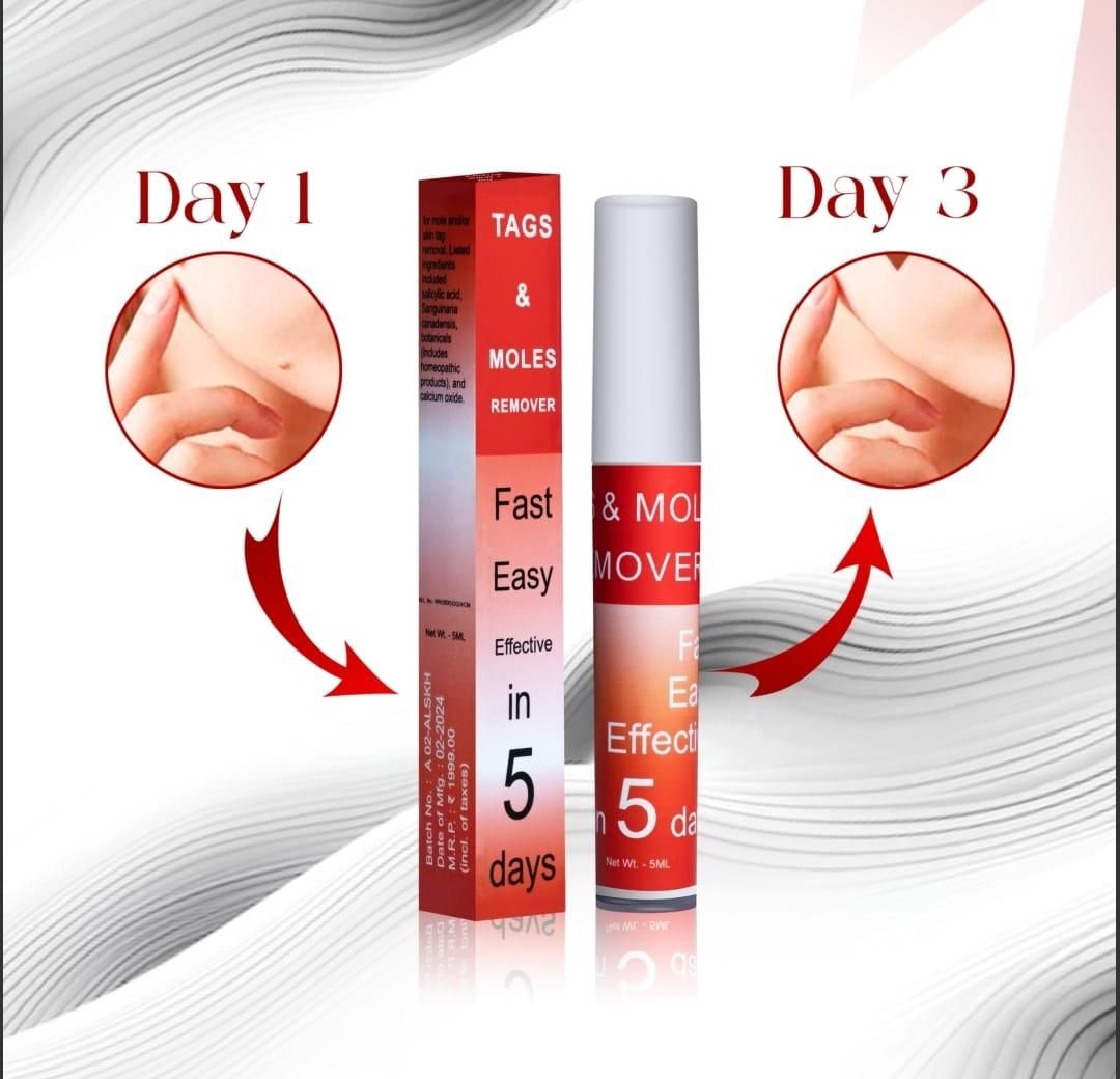 Tags & Moles Remover 🌟
